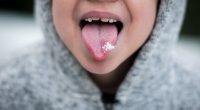 Home Remedies for White Tongue and Bad Breath That Actually