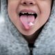 Home Remedies for White Tongue and Bad Breath That Actually